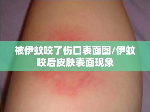 23年是疫情吗（2023年是疫情吗）