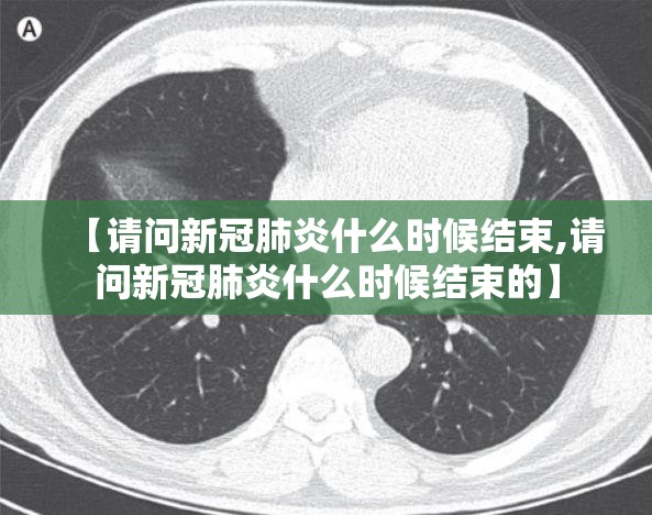 【请问新冠肺炎什么时候结束,请问新冠肺炎什么时候结束的】
