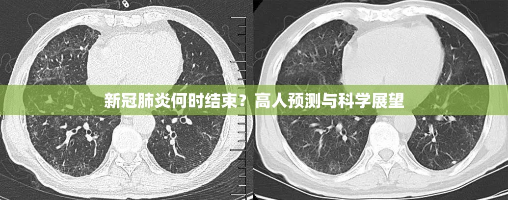 新冠肺炎何时结束？高人预测与科学展望