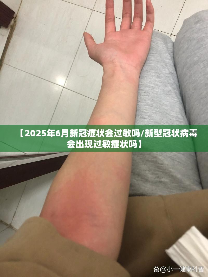 【2025年6月新冠症状会过敏吗/新型冠状病毒会出现过敏症状吗】