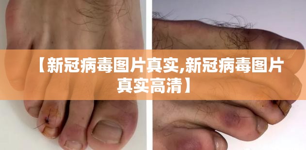 【新冠病毒图片真实,新冠病毒图片真实高清】