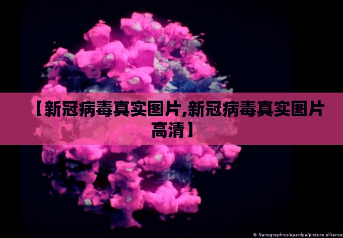 【新冠病毒真实图片,新冠病毒真实图片高清】