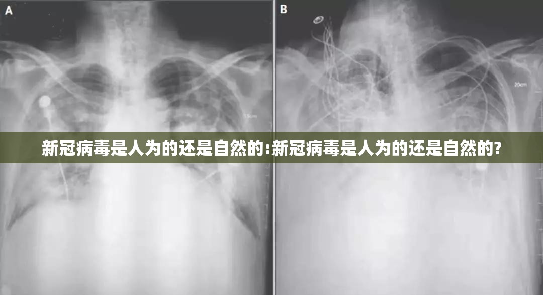 新冠病毒是人为的还是自然的:新冠病毒是人为的还是自然的?