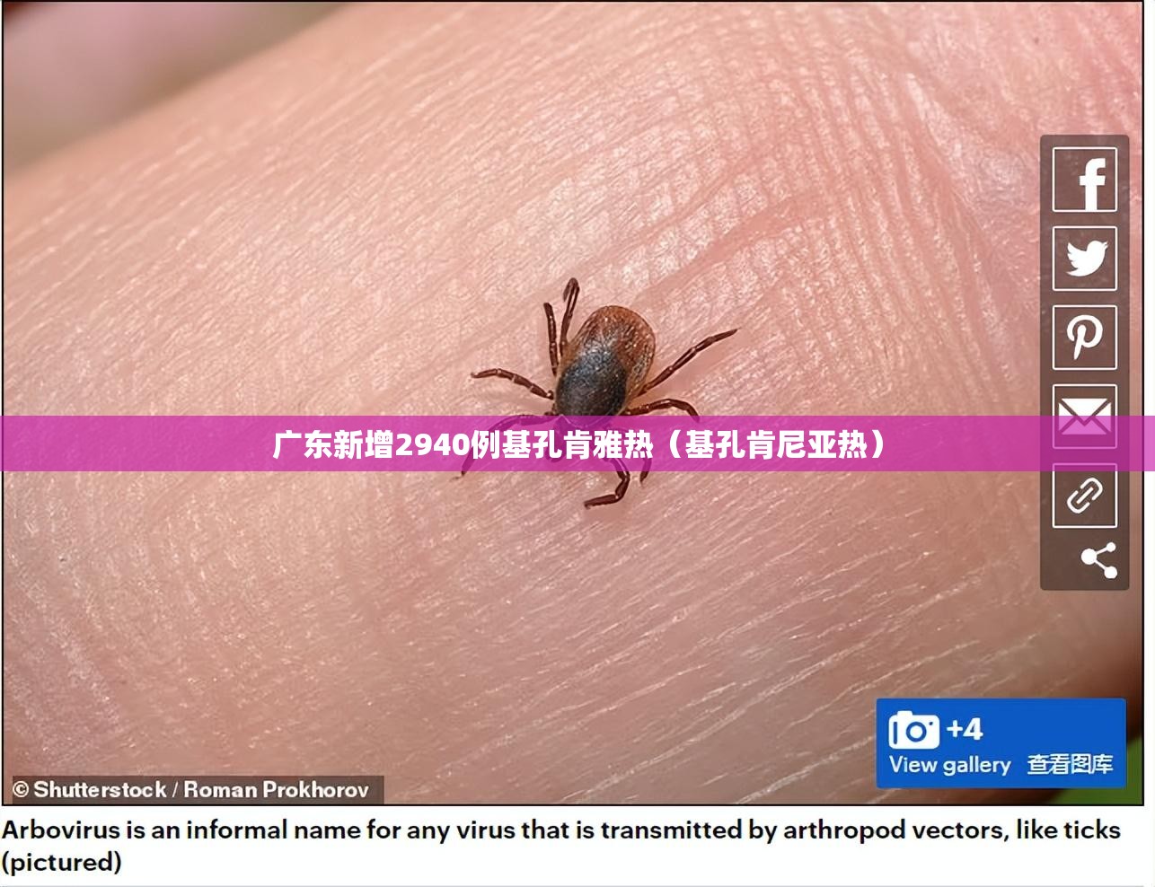 广东新增2940例基孔肯雅热（基孔肯尼亚热）